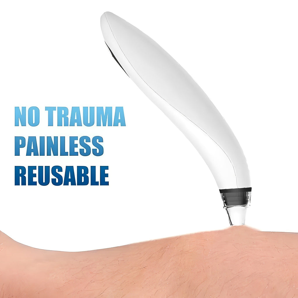 Electric Blackhead Remover & Pore Vacuum Cleaner